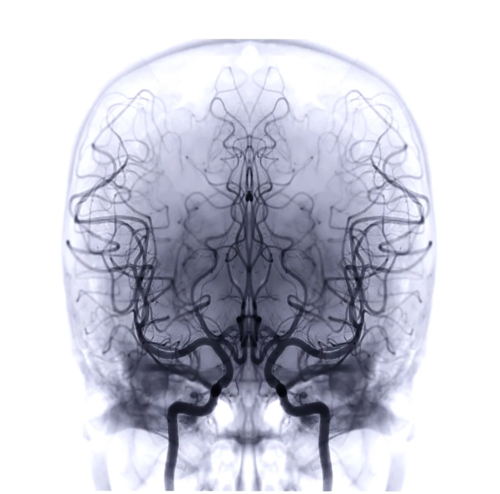 Medical imaging for better diagnostics